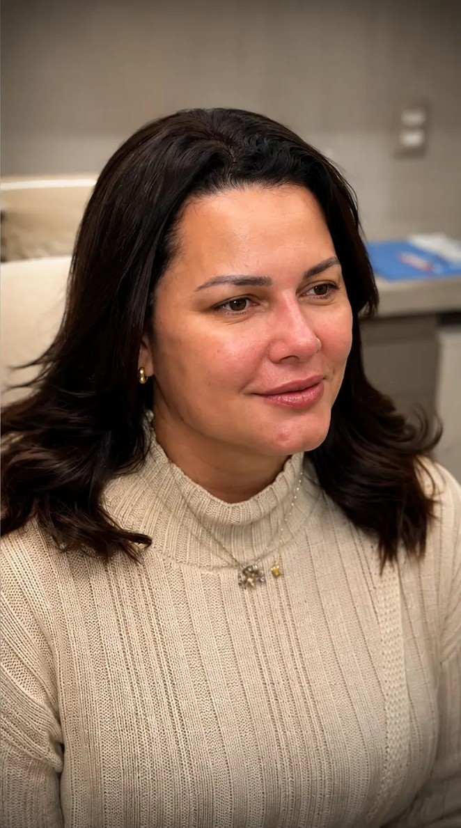Depois — Harmonização facial completa